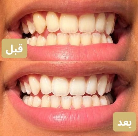 الفرق بين قبل وبعد يتكلم😍